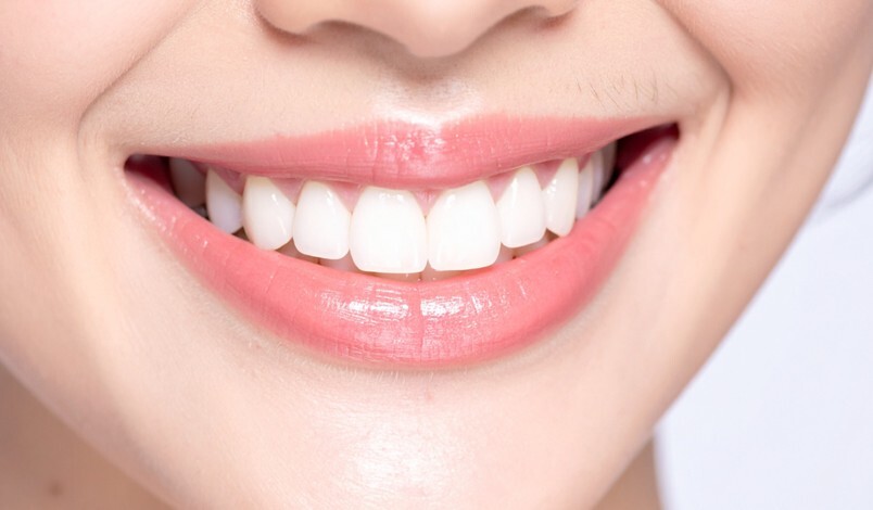 Πώς να αποκτήσεις λαμπερό χαμόγελο χωρίς επεμβάσεις: Η δύναμη του Lifting Δοντιών