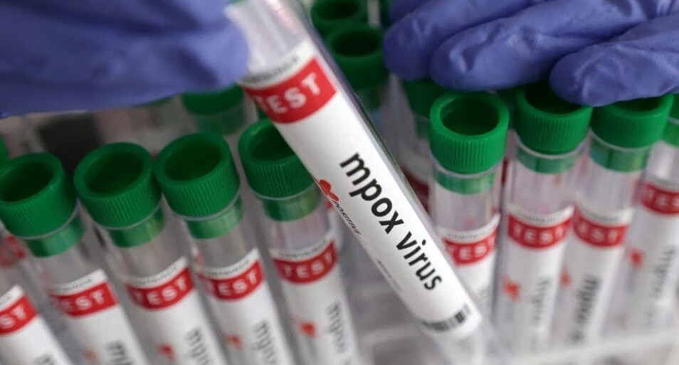 Πρώτο φετινό κρούσμα ευλογιάς των πιθήκων στην Ελλάδα - Άνδρας 45 ετών